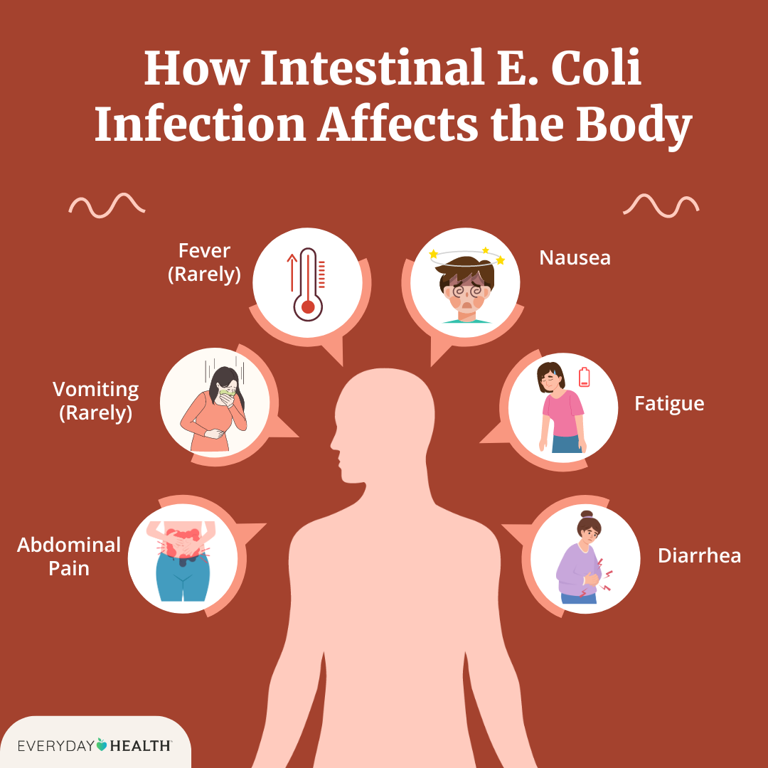 e coli intestinal infection symptoms