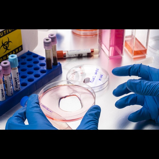 [0501-IL18RAP-8836C] E. Coli Recombinant Rhesus IL18RAP protein, His tagged, Lyophilized   100 ug
