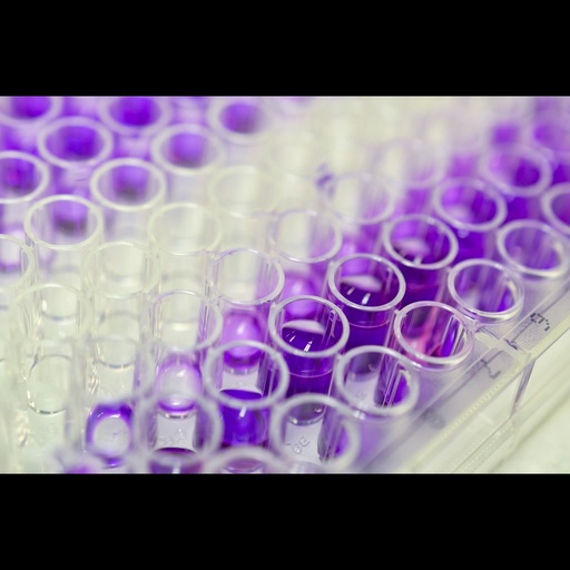 [0772-E5331Hu-96T] Human Glucocorticoid Receptor ''NR3C1'' ELISA Assay   96 wells plate